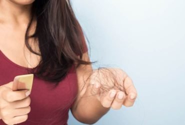 Hair Loss in Women3
