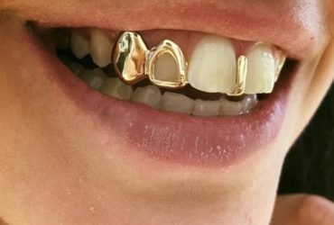 Teeth Grillz 1