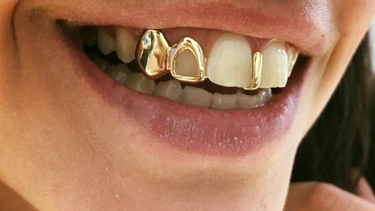 Teeth Grillz 1